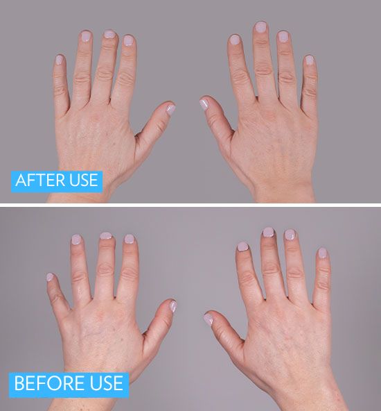 MesoLyft Rejuvenating Gloves