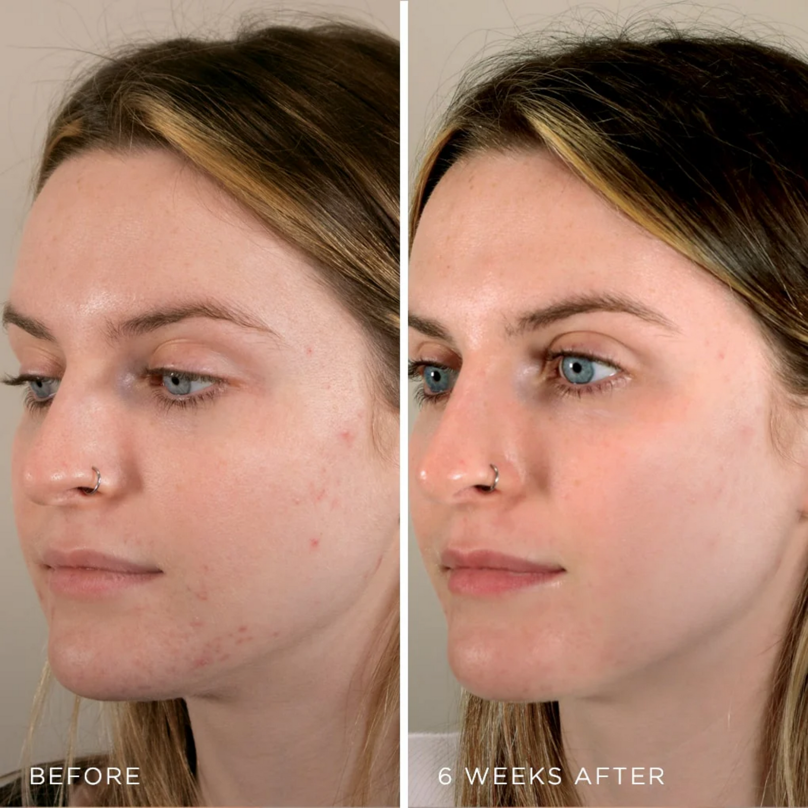 MesoLyft Rejuvenating Mask