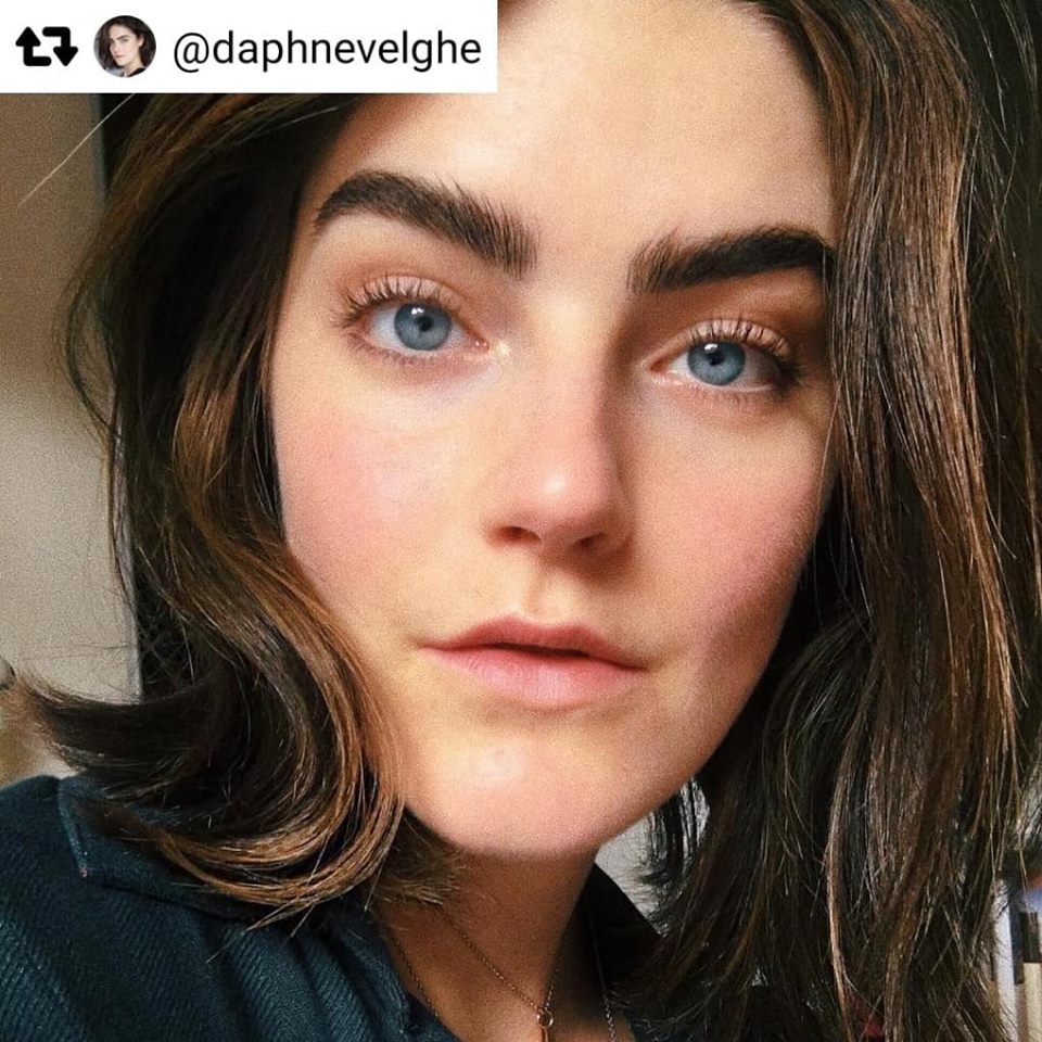 remove forehead wrinkles