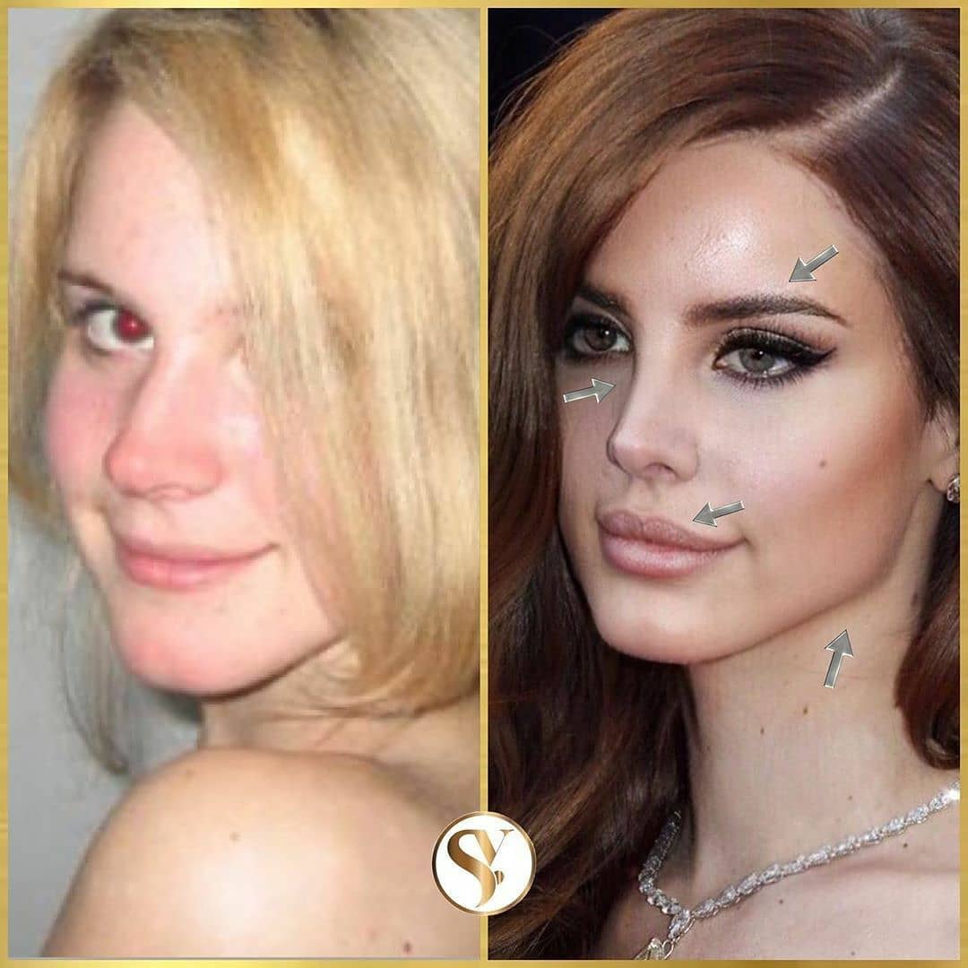 Instant wrinkle remover