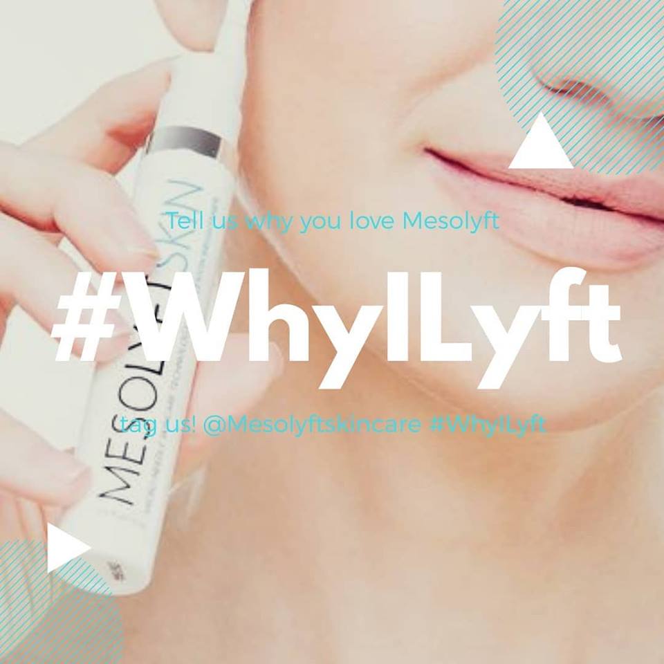 Microneedling for acne scars