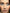 micro needling for acne scars