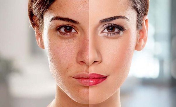 Skin Lightening Products with Known Skin Tool