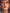 dermarolling lips
