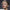 lip augmentation products