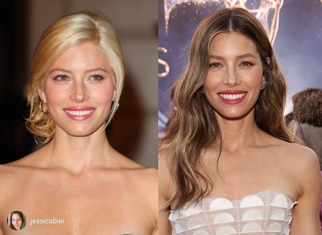 Adequate Neck Skin Treatment By Top Dermatologists