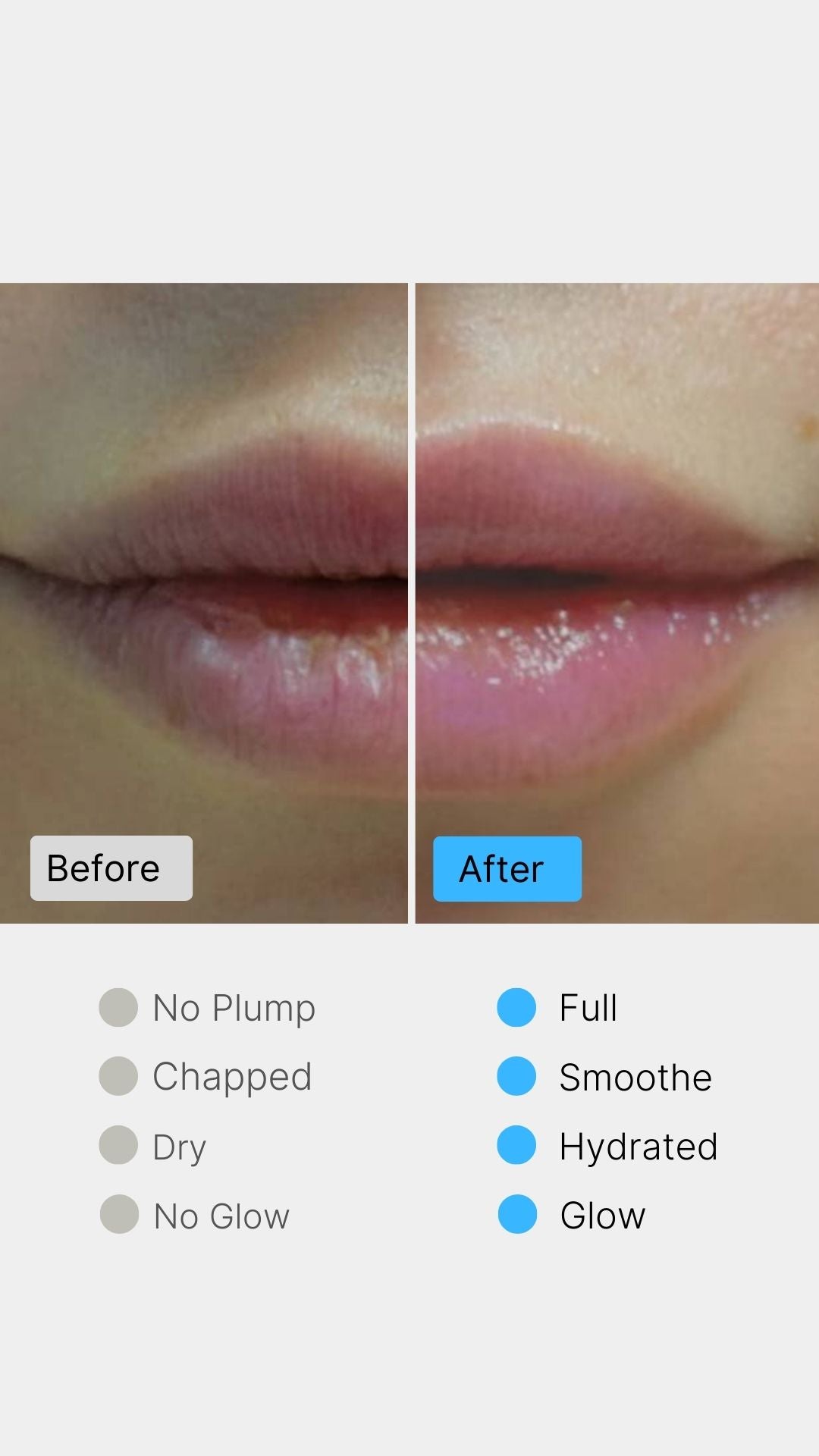 MesoLyft Lips Roller