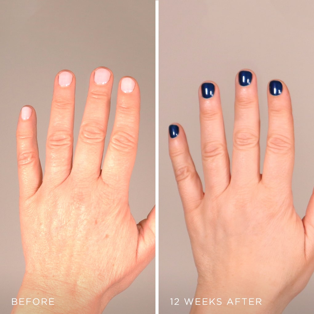 MesoLyft Rejuvenating Gloves