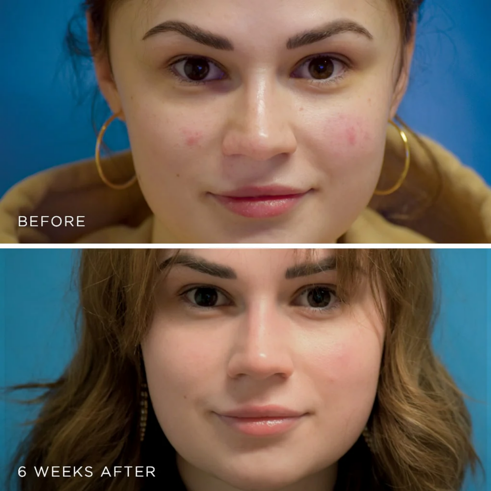 MesoLyft Rejuvenating Mask