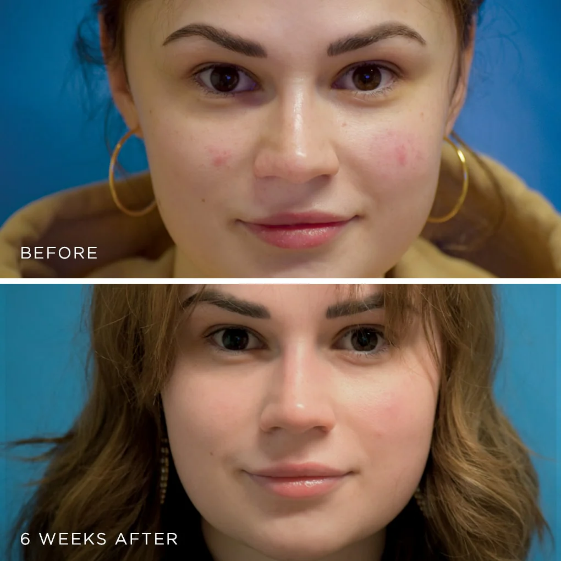 MesoLyft Rejuvenating Mask